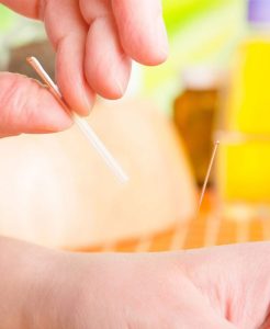 acupunctura zhendao