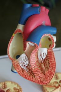 aritmia cardiaca