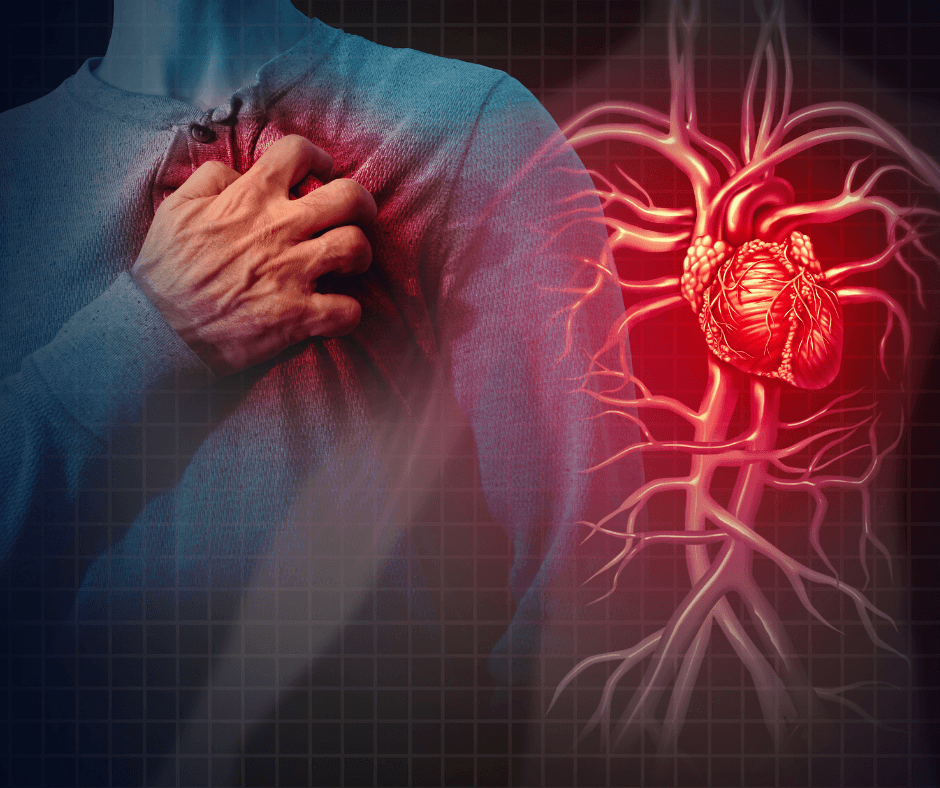 bolile cardiovasculare anevrismul aortic AVC